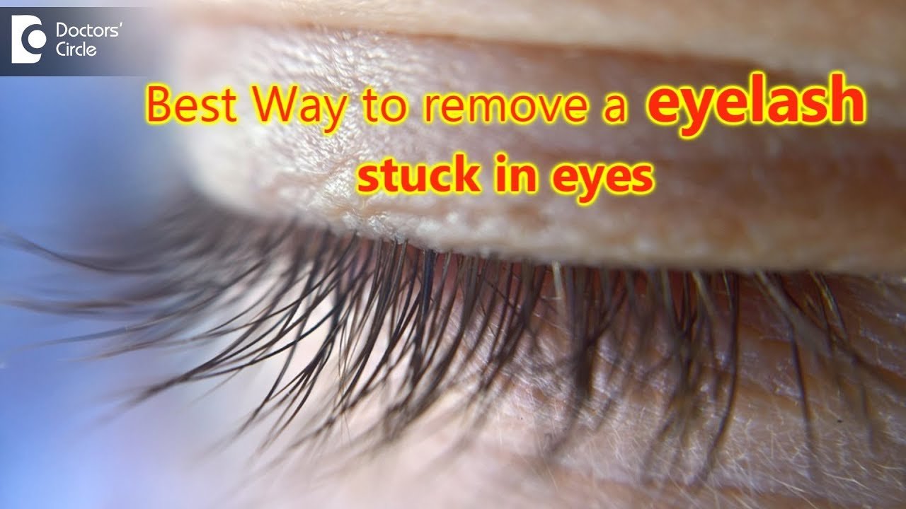 What happens if an eyelash gets stuck in your eye